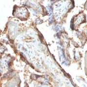 FFPE human placenta sections stained with 100 ul anti-Human Chorionic Gonadotropin (clone HCGab/52) at 1:50. HIER epitope retrieval prior to staining was performed in 10mM Citrate, pH 6.0.